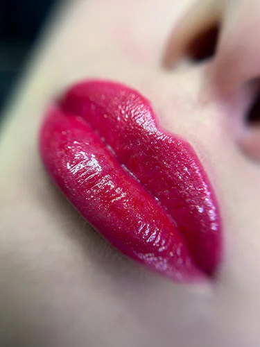 foto9
